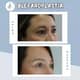 Slider image (9) Dr. Felipe Castro Esguerra - Plastic Surgeon in Colombia